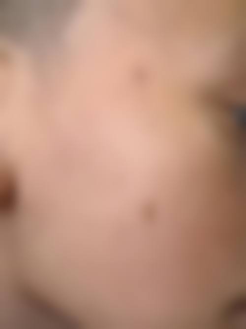 五、武汉伽美星医疗美容医院价格表