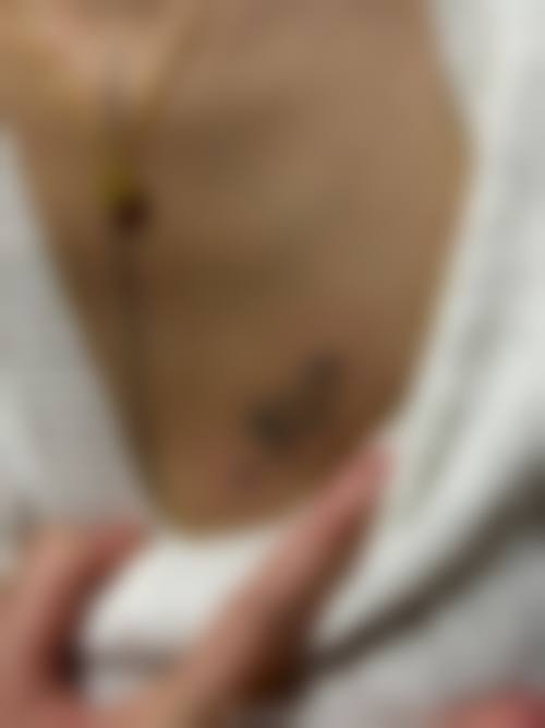 五、今井皮肤形成价格表