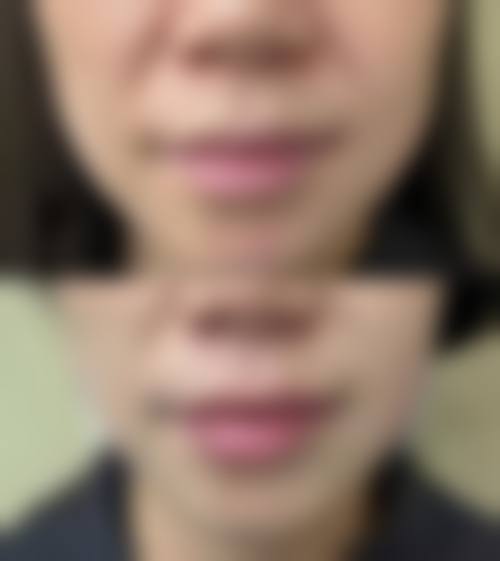 六、宁波美仁医疗美容价格表