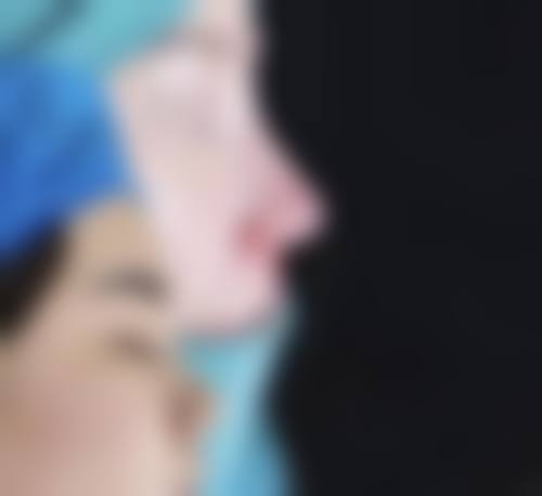 三、张二伟技术优势