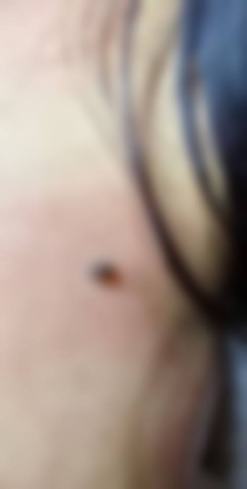 四、山东济南美莱整形医院特色项目