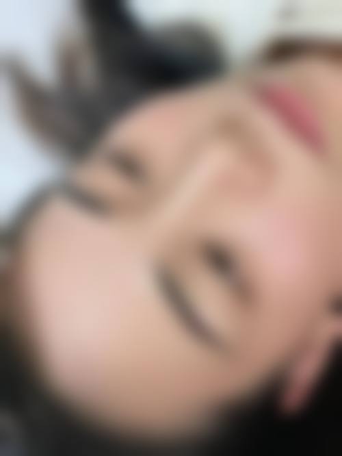 四、武汉伽美星医疗美容医院特色项目