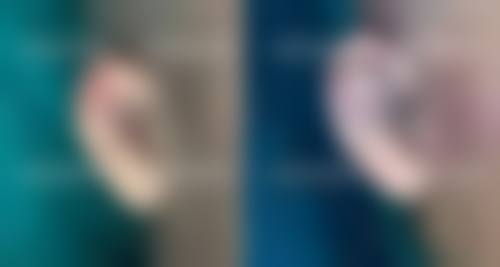 八、武汉伽美星医疗美容医院真实的患者评价