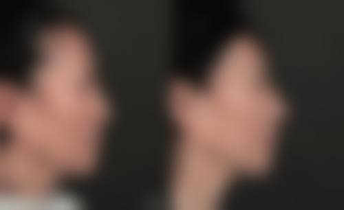 九、郑州第一人民医院整形外科真实的患者评价