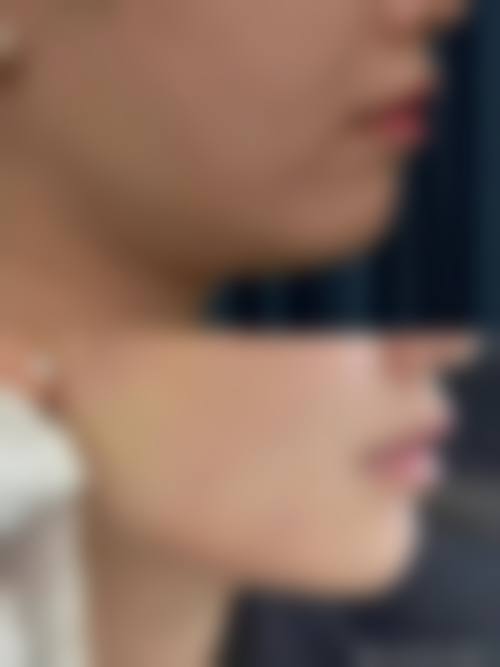 五、大连锐斯医疗美容诊所价格表