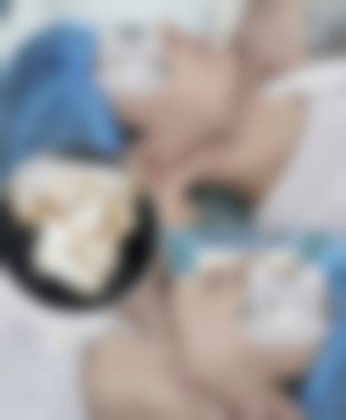 六、广州增城德玛肤奢颜整形医院价格表