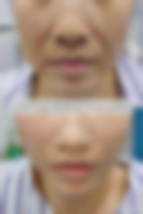 三、福建福州安心新颜整形医院诊疗项目有哪些？