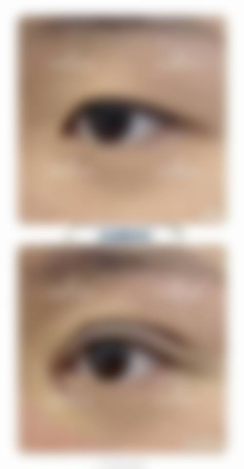 九、邛崃星宸医学美容诊所真实的患者评价