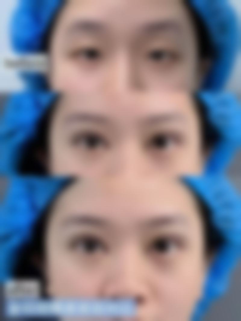 三、郑州第一人民医院整形外科诊疗项目有哪些?