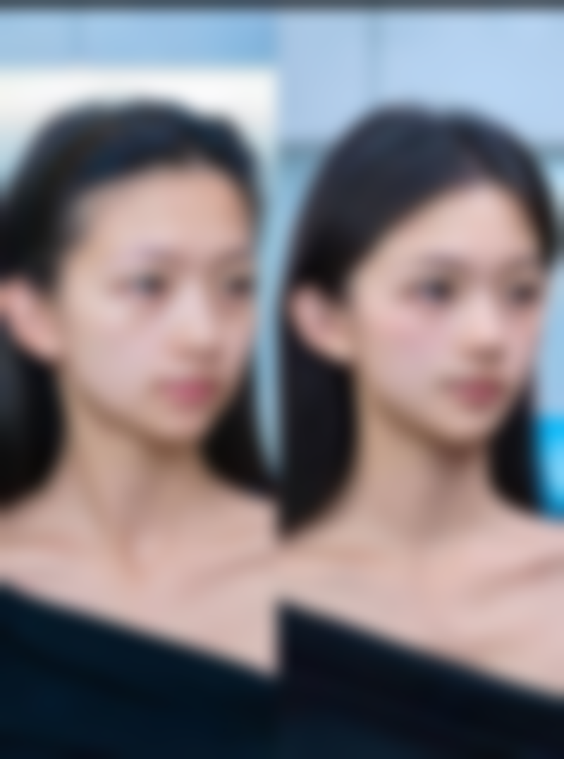 二、瘦脸针注射副作用的风险因素