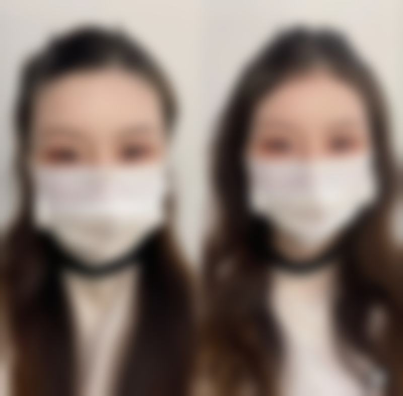 三、山东济南美莱整形医院诊疗项目有哪些?