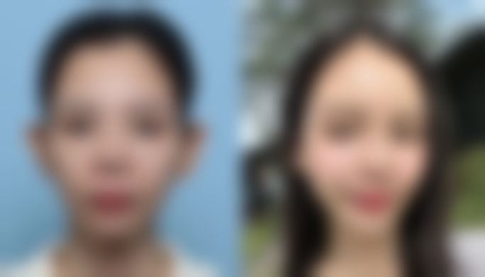 六、兰州中泰整形美容医院价格表