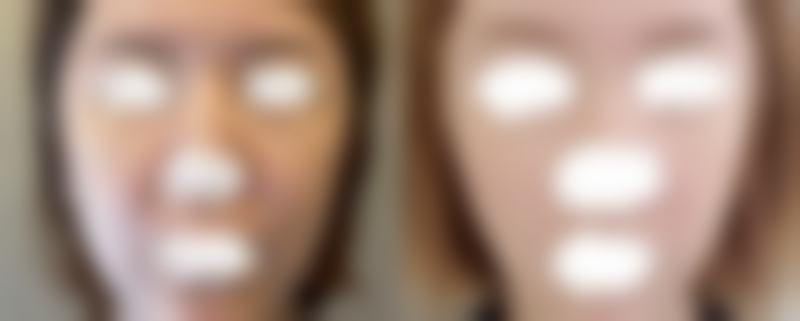 八、大连锐斯医疗美容诊所真实的患者评价