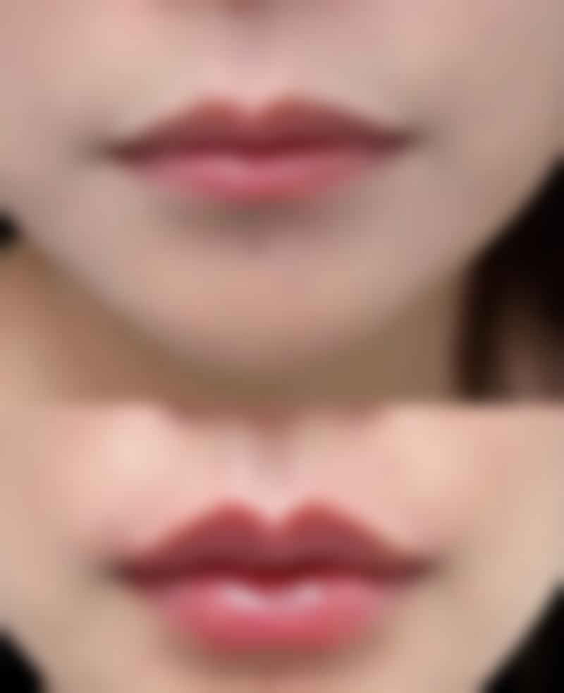 二、生活调理改善女性眼袋大