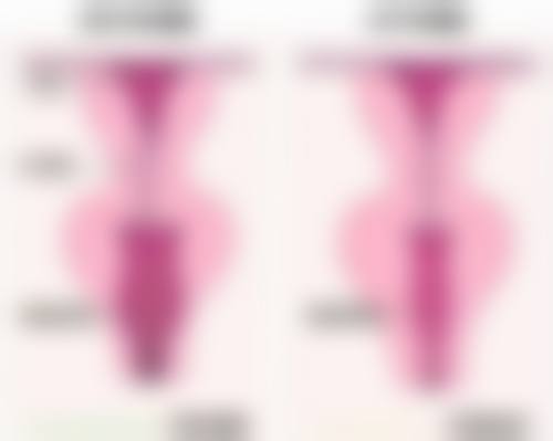 三、延长除皱针打一次成效的实用方法