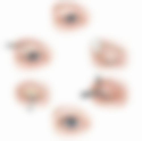 四、术后美学维护提示