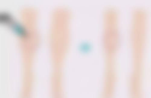 一、除皱针打一次能管多久的基本情况