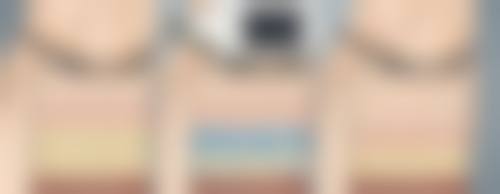 二、哪些因素会影响激光消除手术疤痕的成效？