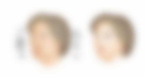 四、为什么拆线后疤痕越来越明显之护理因素