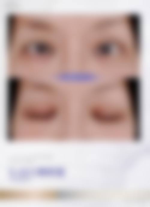 二、深圳星荟丽格医疗美容怎么样？