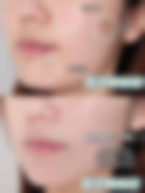 三、扬州赛美瑞整形美容医院诊疗项目有哪些？