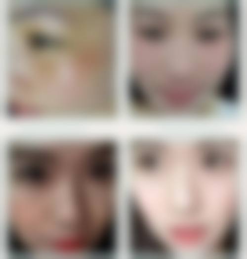 六、深圳远东妇儿科医院医疗美容科价格表