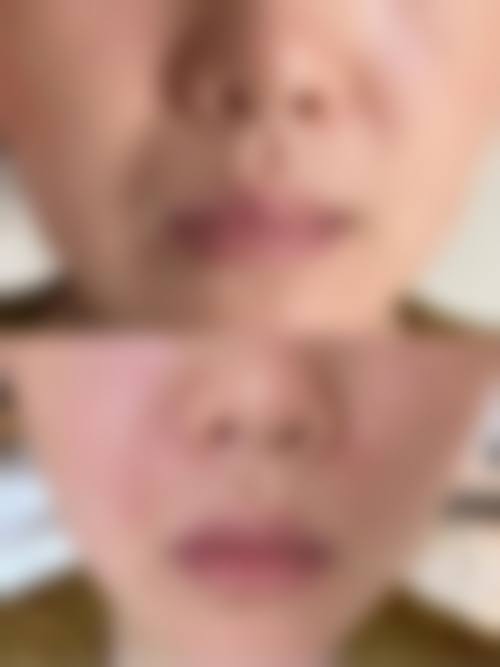 四、济南奥维丽医疗美容诊所特色项目