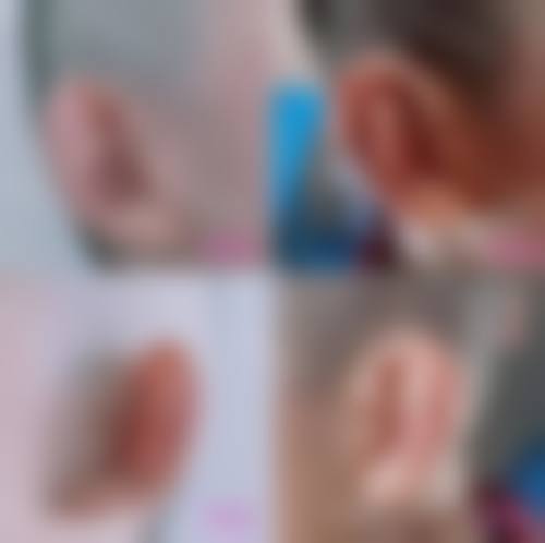 八、重庆木槿整形美容医院预约方式