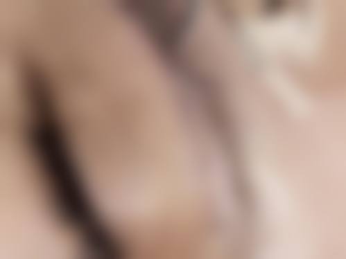 八、合肥大麦微针植发医院预约方式