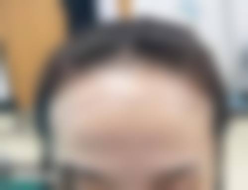 四、南京肤康皮肤病门诊部特色项目