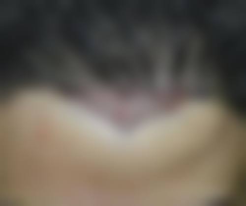 七、合肥大麦微针植发医院地址及交通