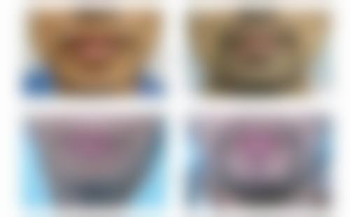 三、合肥大麦微针植发医院诊疗项目有哪些？