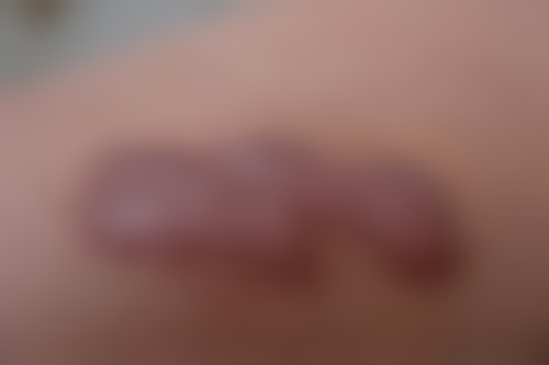 四、武汉宝嘉丽医疗美容诊所特色项目