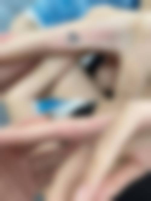 二、中山美熙整形医院怎么样？