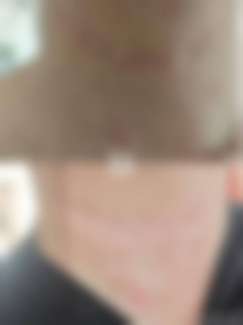 四、扬州赛美瑞整形美容医院特色项目