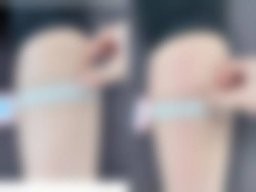 四、DB整形外科特色项目