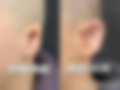 九、深圳远东妇儿科医院医疗美容科真实的患者评价