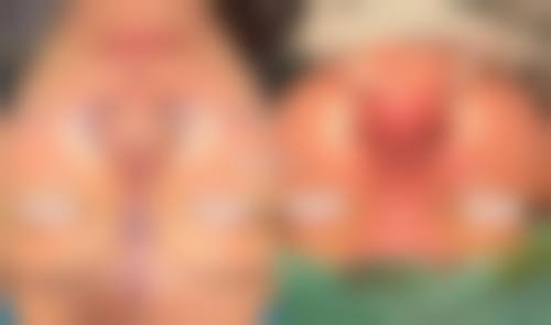 八、台州倍芙谜整形医院真实的患者评价