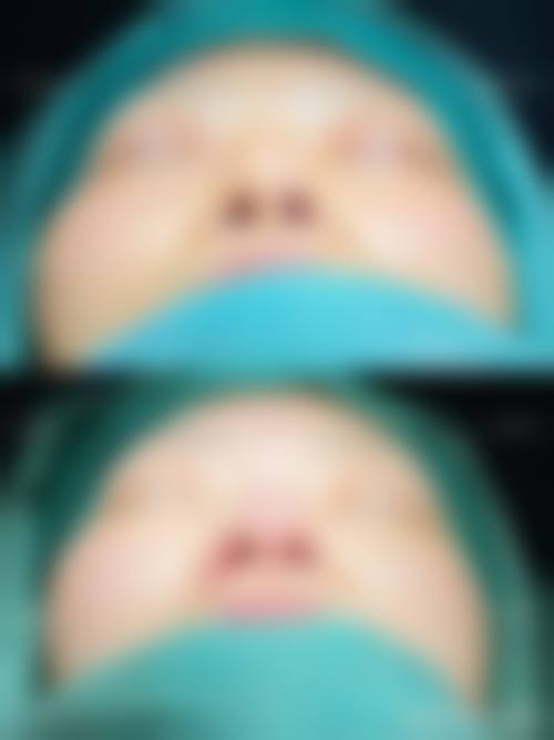 五、台州倍芙谜整形医院价格表