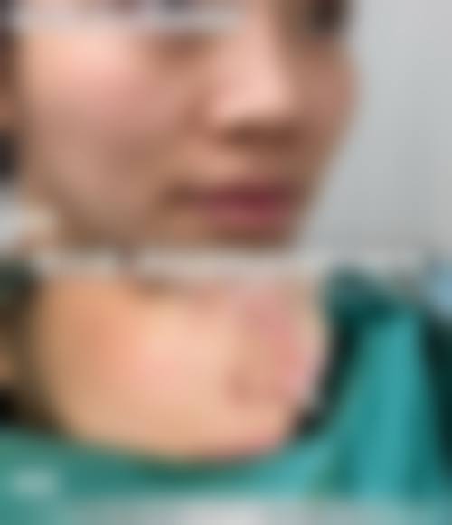 五、韩国 Gold 三星整形外科价格表