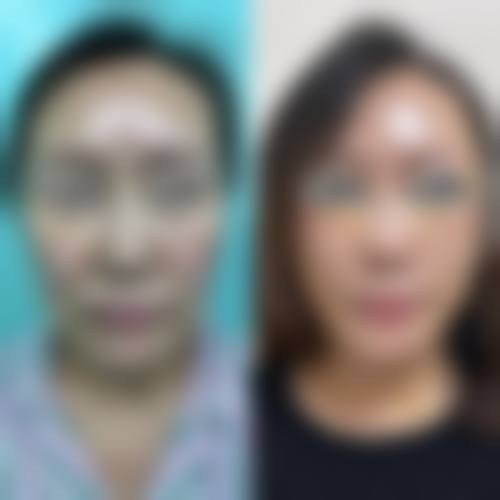 八、延吉吕艳霞整形医疗美容诊所预约方式