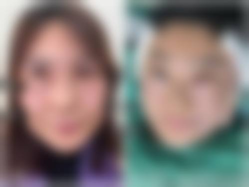 四、韩国 Gold 三星整形外科特色项目