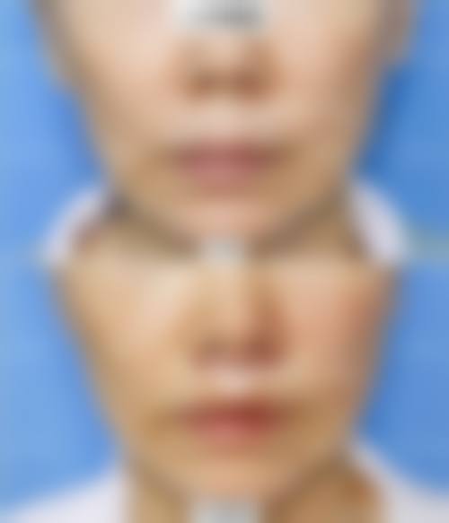 九、简阳精颜整形医院真实的患者评价