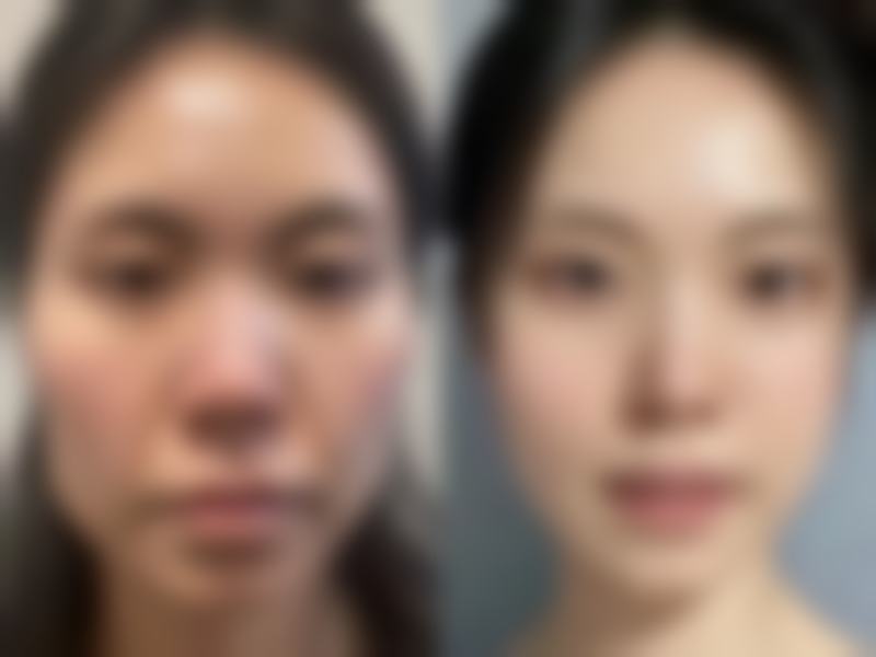 三、郭勇技术优势