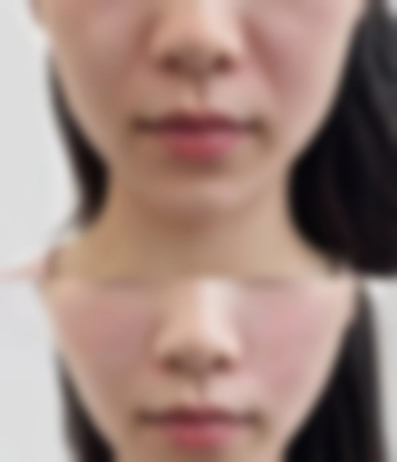 四、郑州医德佳医院（原华 山医院）特色项目