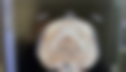 隆鼻手术半个月抽烟会引起感染吗