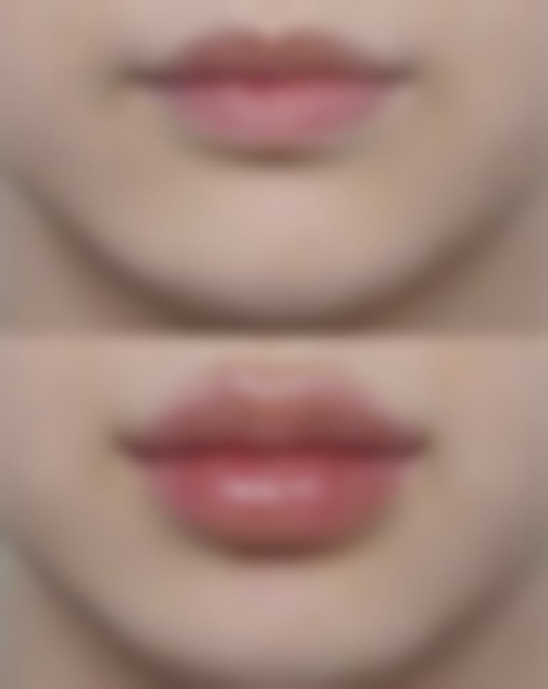 一、为什么拆线后疤痕越来越明显之正常生理现象