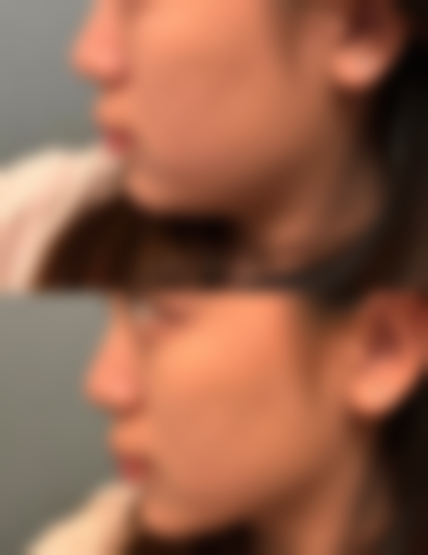 六、曹江虹真实的患者评价