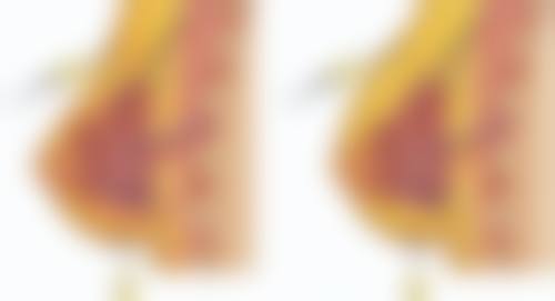 二、影响假体隆胸修复时间的因素