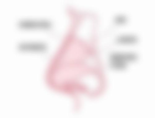 二、不同类型眼袋与超声炮的适用性